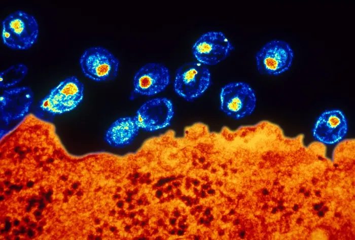 Framed Print : AIDS Virus (TEM)
