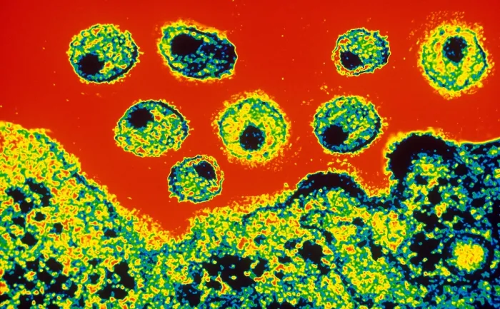 Framed Print : AIDS Virus (TEM) Framed Print : AIDS Virus (TEM)