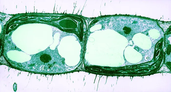 Framed Print : Algae Cell Division, Cylindrocapsa brebissonii Framed Print : Algae Cell Division, Cylindrocapsa brebissonii