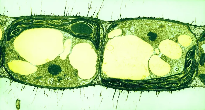 Framed Print : Algae Cell Division, Cylindrocapsa brebissonii Framed Print : Algae Cell Division, Cylindrocapsa brebissonii