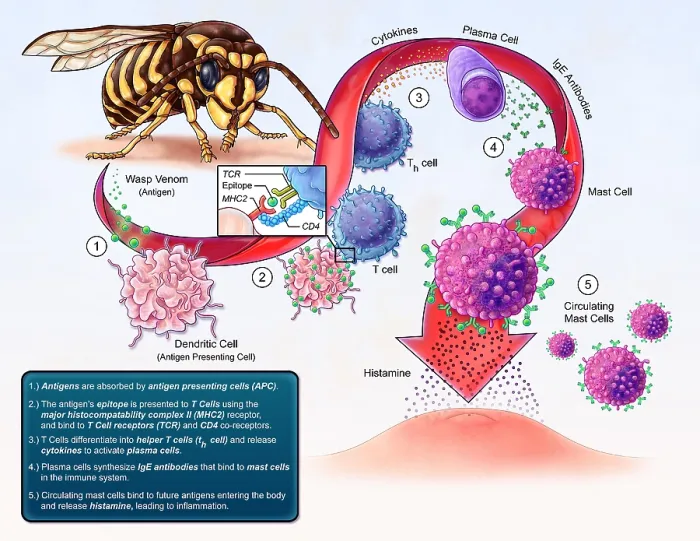 Framed Print : Allergy Development, illustration Framed Print : Allergy Development, illustration