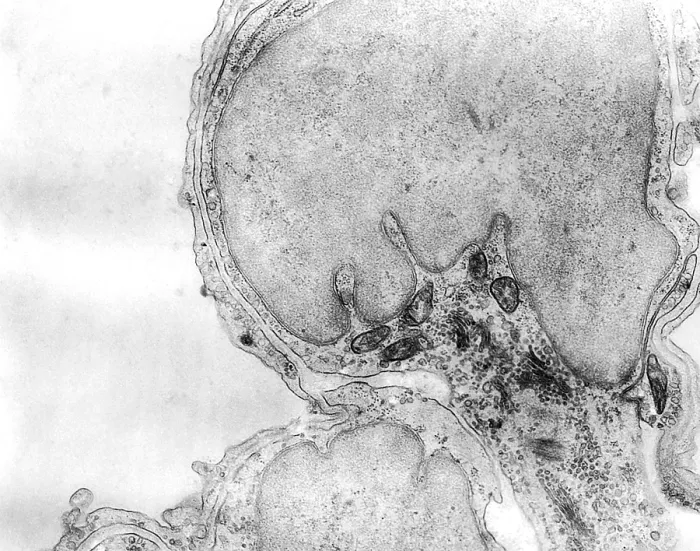 Framed Print : Alveolar capillary Framed Print : Alveolar capillary