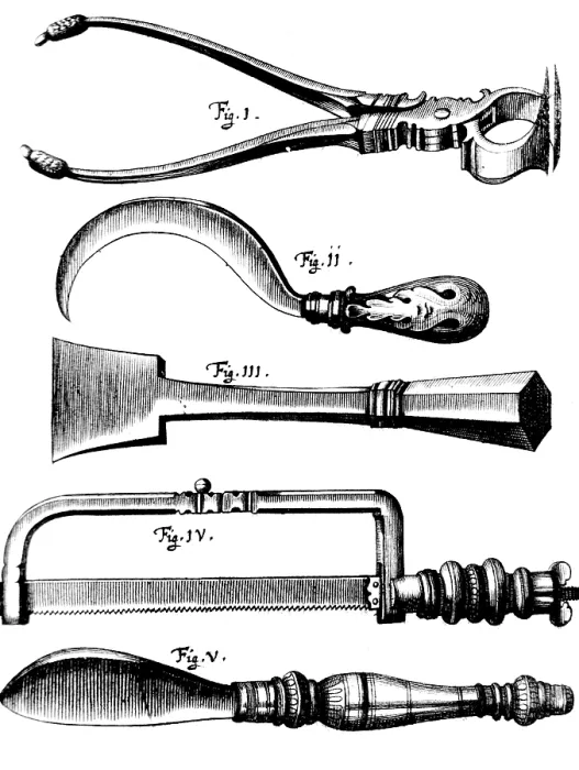 Framed Print : Amputation Instruments, 1772