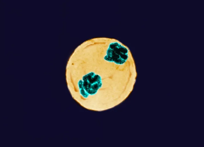Framed Print : Anaphase of Mitosis in Trillium Cell Framed Print : Anaphase of Mitosis in Trillium Cell