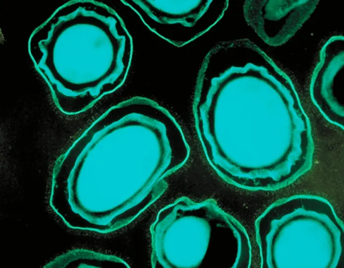 Framed Print : Anthrax spores Framed Print : Anthrax spores
