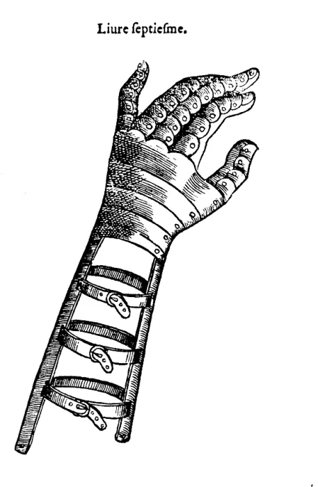 Framed Print : Artificial Hand Designed by Ambroise Pare, 1564