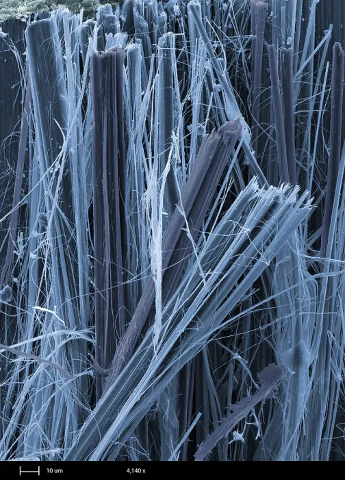 Framed Print : Asbestos, under a microscope (SEM) Framed Print : Asbestos, under a microscope (SEM)