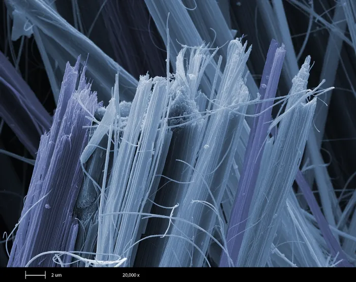 Framed Print : Asbestos, under a microscope (SEM) Framed Print : Asbestos, under a microscope (SEM)