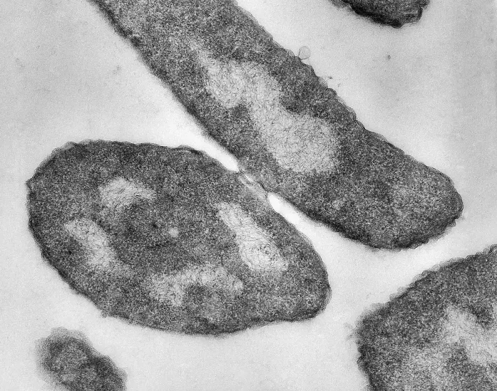Framed Print : Bacteria, Genetic Recombination, TEM