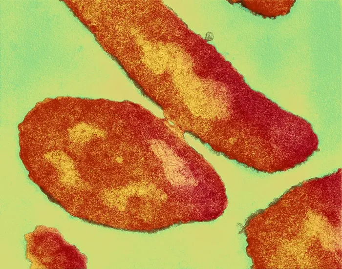 Framed Print : Bacteria, Genetic Recombination, TEM
