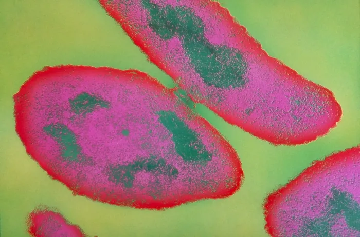 Framed Print : Bacteria, Genetic Recombination, TEM Framed Print : Bacteria, Genetic Recombination, TEM