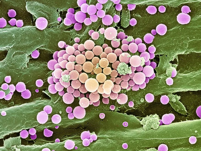 Framed Print : Bacteria on Hops Leaf, under a microscope (SEM) Framed Print : Bacteria on Hops Leaf, under a microscope (SEM)