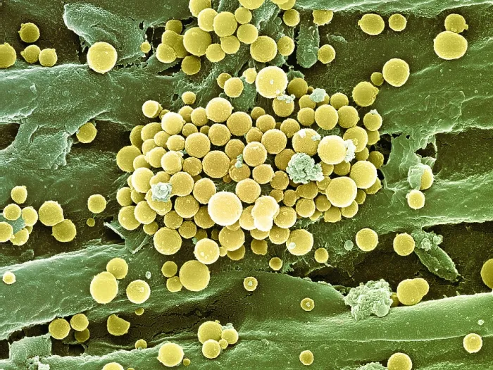 Framed Print : Bacteria on Hops Leaf, scanning electron micrograph Framed Print : Bacteria on Hops Leaf, scanning electron micrograph