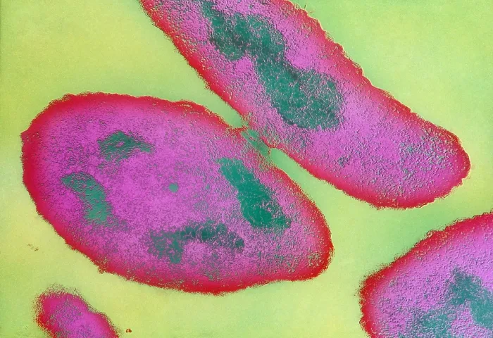 Framed Print : Bacteria Reproducing Framed Print : Bacteria Reproducing