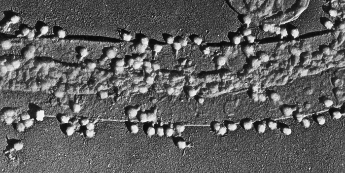 Framed Print : Bacteriophage T-2 Infecting E. coli Cell Wall, TEM Framed Print : Bacteriophage T-2 Infecting E. coli Cell Wall, TEM