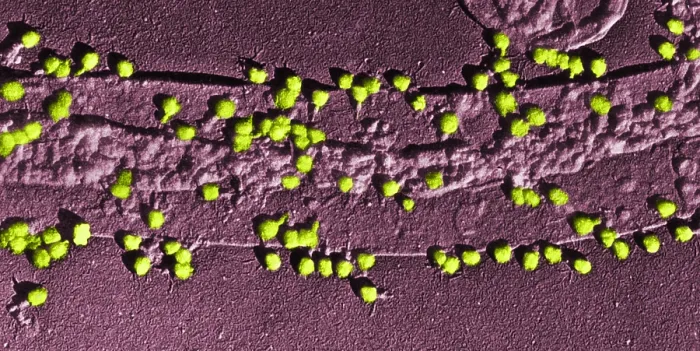 Framed Print : Bacteriophage T-2 Infecting E. coli Cell Wall, TEM