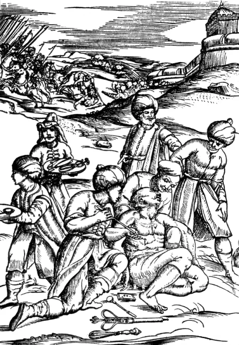 Framed Print : Battlefield Medicine, 16th Century Framed Print : Battlefield Medicine, 16th Century