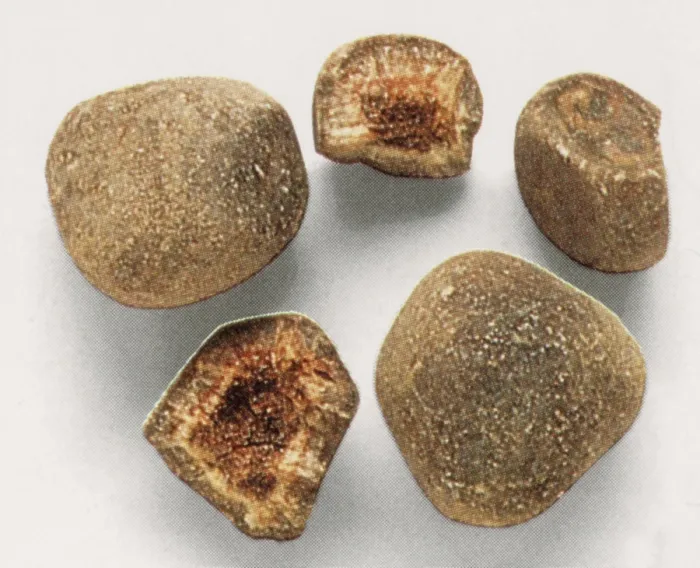 Framed Print : Bezoar Stones, Medieval Antidote for Poisoning, gross specimen Framed Print : Bezoar Stones, Medieval Antidote for Poisoning, gross specimen