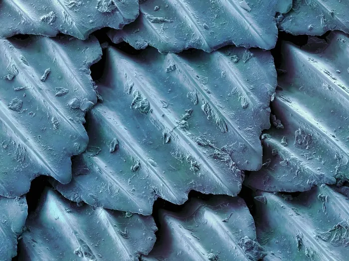 Framed Print : Blacktip Reef Shark Skin, under a microscope (SEM)