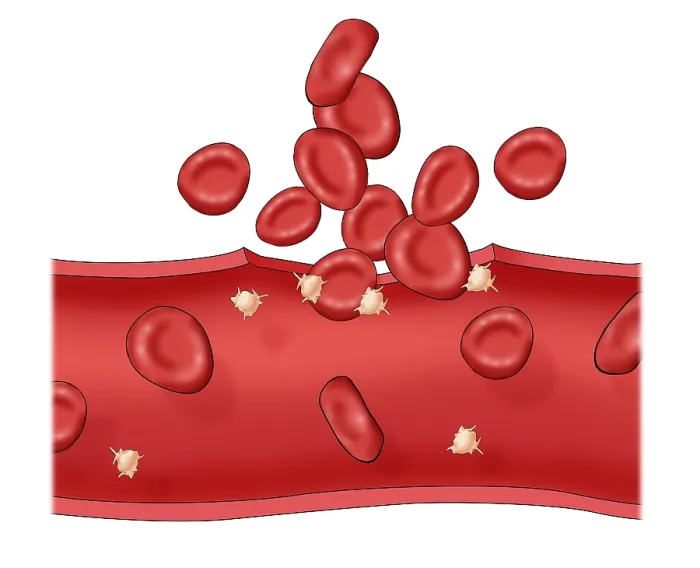 Framed Print : Blood clot Framed Print : Blood clot