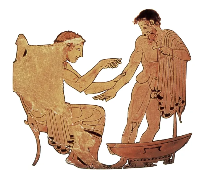 Framed Print : Bloodletting of Ancient Greek Patient, 480-470 BC Framed Print : Bloodletting of Ancient Greek Patient, 480-470 BC