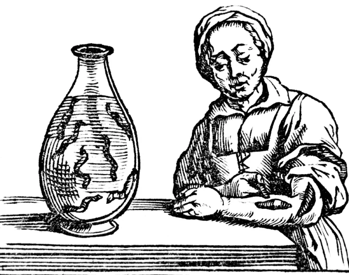 Framed Print : Bloodletting, Leech Method Framed Print : Bloodletting, Leech Method