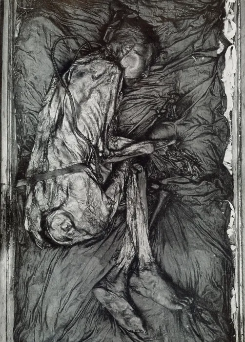 Framed Print : Body of a man found in a peat bog, 1950 Framed Print : Body of a man found in a peat bog, 1950