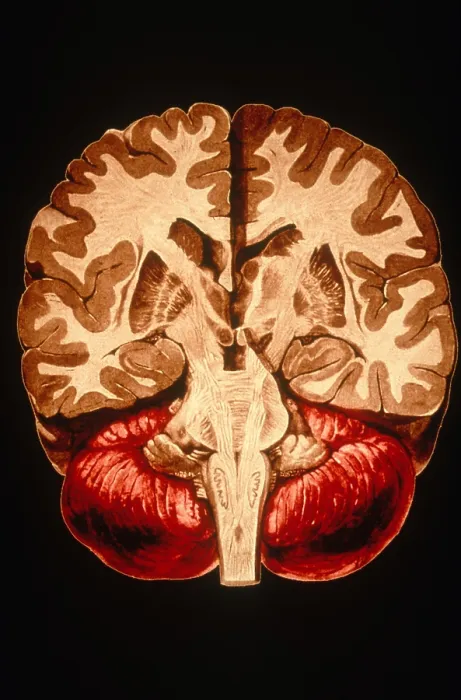 Framed Print : Brain, Coronal Section Framed Print : Brain, Coronal Section