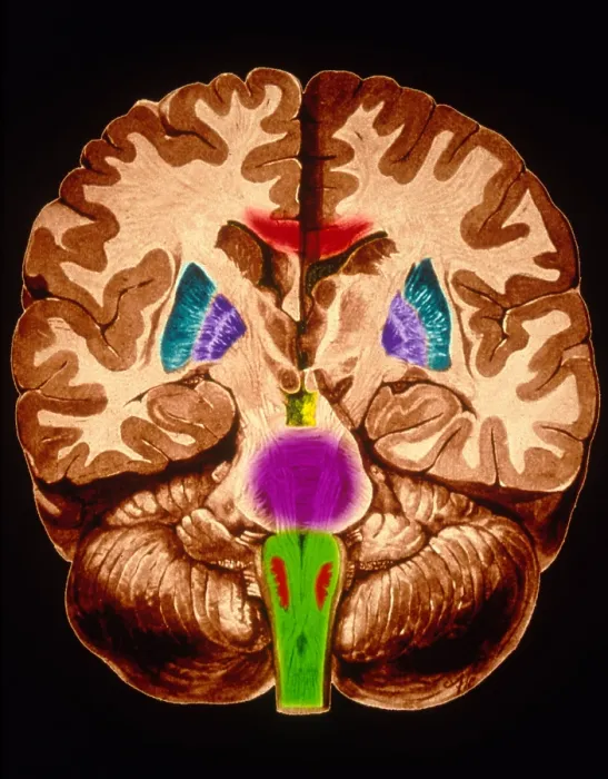 Framed Print : Brain, Coronal Section Framed Print : Brain, Coronal Section