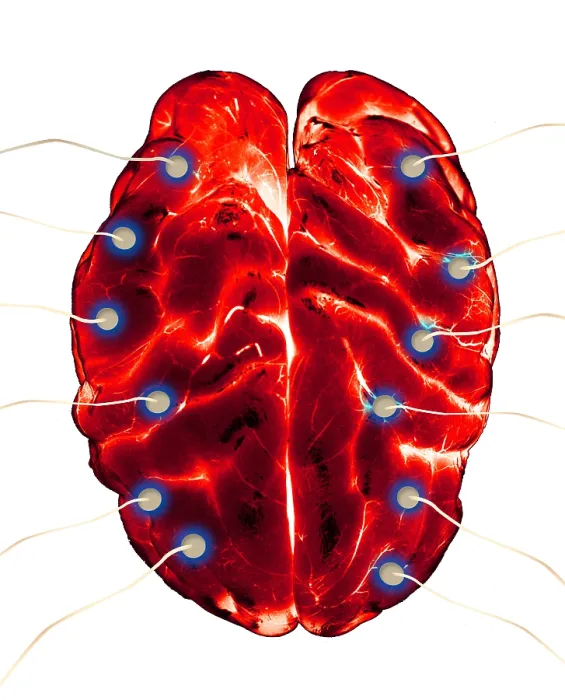 Framed Print : Brain EEG. Illustration of a brain undergoing an EEG (electroencephalogram) Framed Print : Brain EEG. Illustration of a brain undergoing an EEG (electroencephalogram)