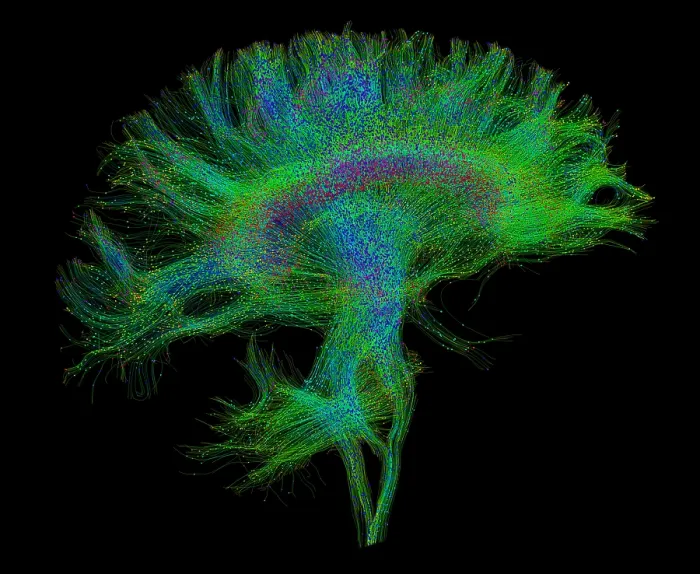 Framed Print : Brain, Fiber Tractography Image