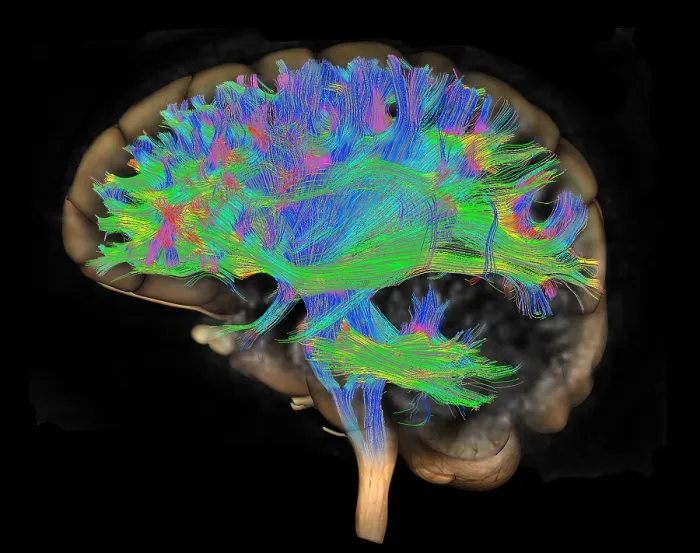 Framed Print : Brain, Fiber Tractography Image Framed Print : Brain, Fiber Tractography Image