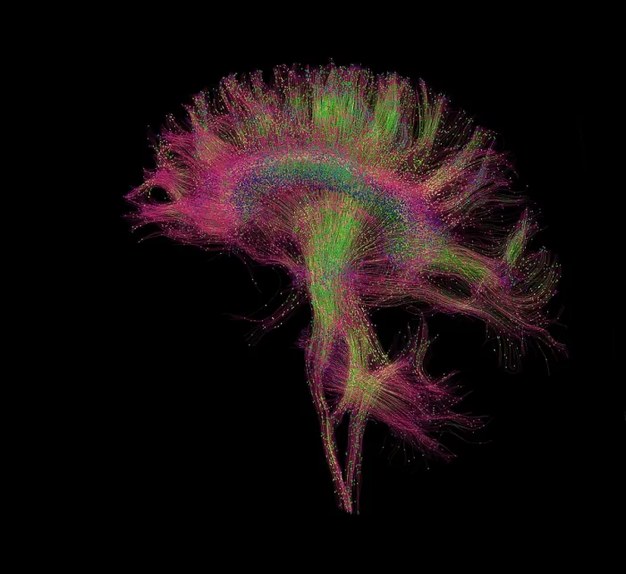 Framed Print : Brain, Fiber Tractography Image Framed Print : Brain, Fiber Tractography Image