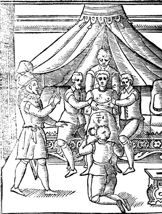 Framed Print : Caesarean Section, 17th Century