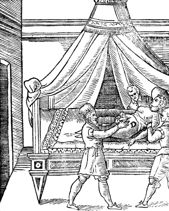 Framed Print : Caesarean Section, 17th Century Framed Print : Caesarean Section, 17th Century