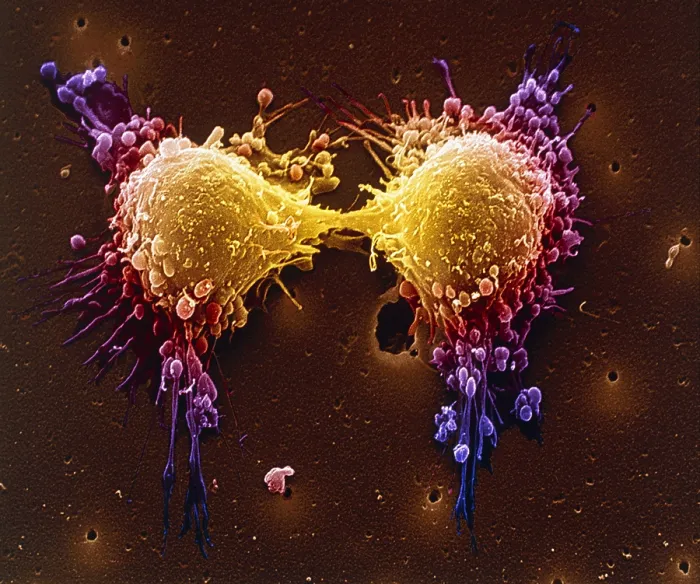 Framed Print : Cancer cell division