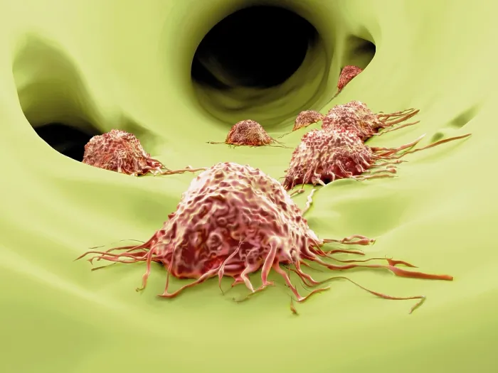 Framed Print : Cancer cells, artwork