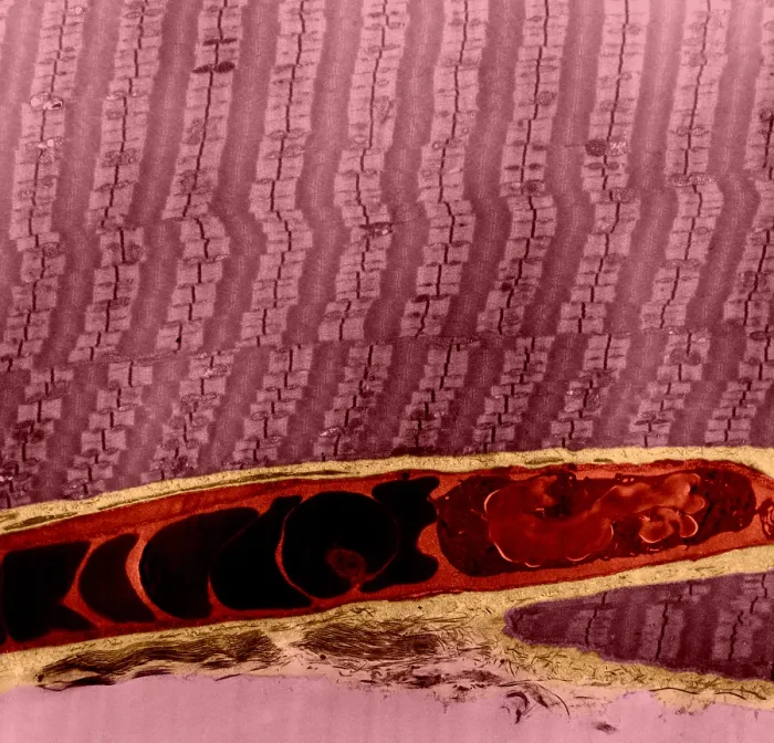 Framed Print : Capillary Between Muscle Fibers, TEM Framed Print : Capillary Between Muscle Fibers, TEM