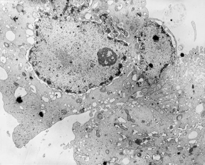 Framed Print : Cell Death, TEM