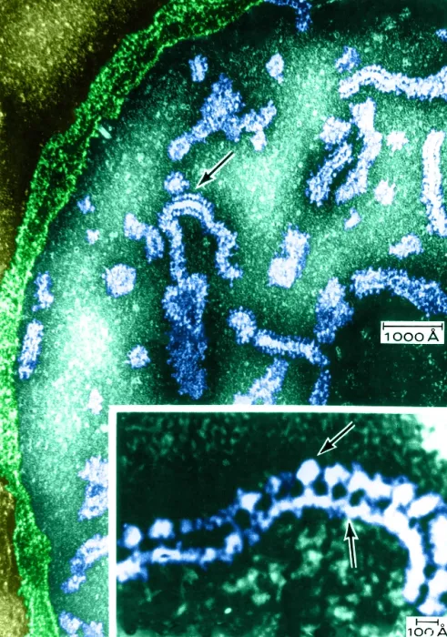 Framed Print : Cell Structure, Mitochondria, TEM Framed Print : Cell Structure, Mitochondria, TEM