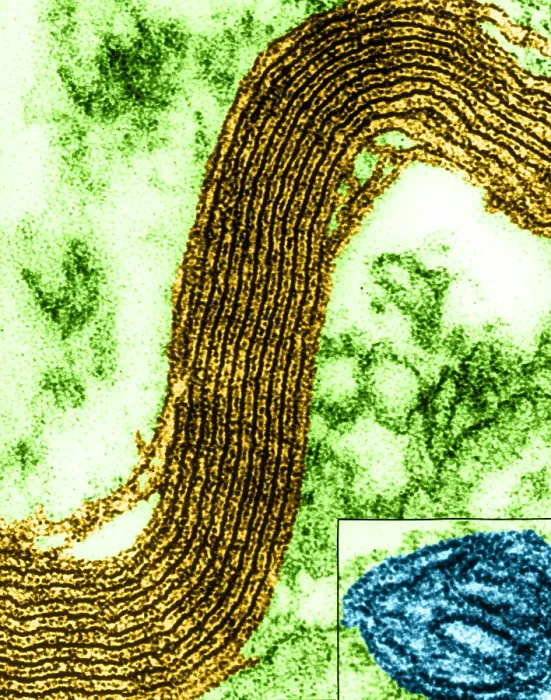Framed Print : Cell Structure, Myelin Sheath, TEM Framed Print : Cell Structure, Myelin Sheath, TEM