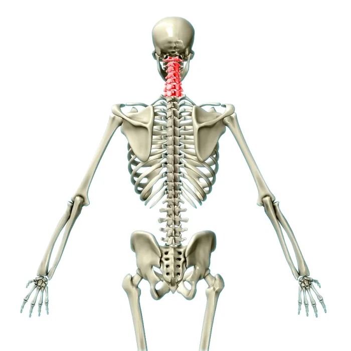 Framed Print : Cervical Vertebrae, Illustration Framed Print : Cervical Vertebrae, Illustration