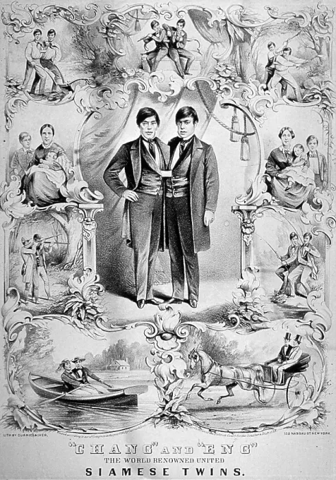 Framed Print : Chang and Eng Bunker, The Original Siamese Twins Framed Print : Chang and Eng Bunker, The Original Siamese Twins