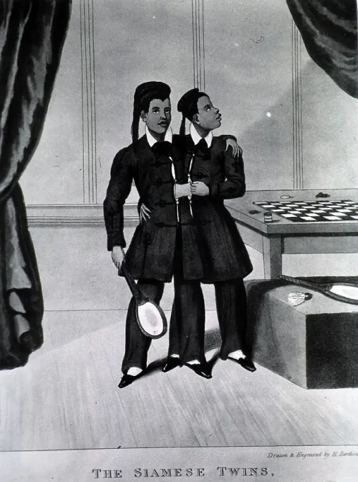 Framed Print : Chang and Eng Bunker, The Original Siamese Twins Framed Print : Chang and Eng Bunker, The Original Siamese Twins