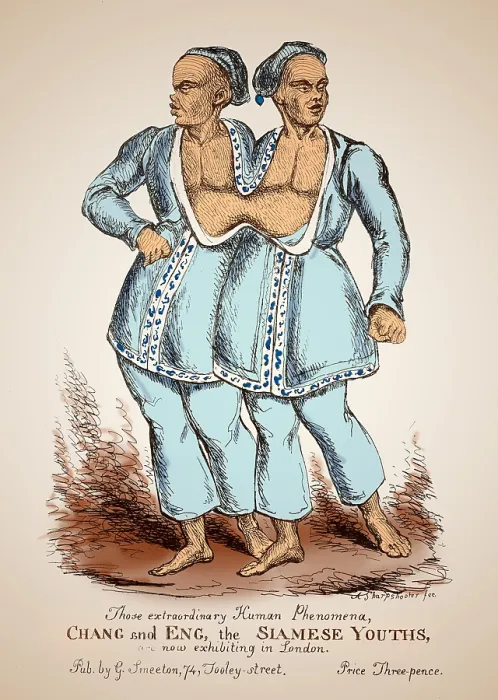 Framed Print : Chang and Eng Bunker, Siamese Twins
