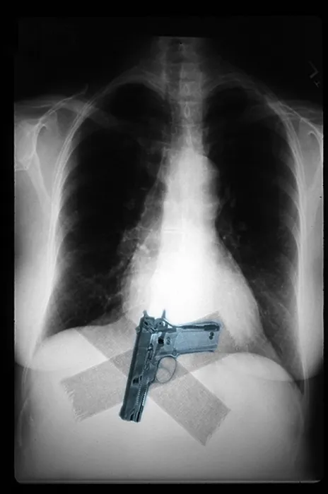 Framed Print : Chest x-ray showing hidden gun Framed Print : Chest x-ray showing hidden gun