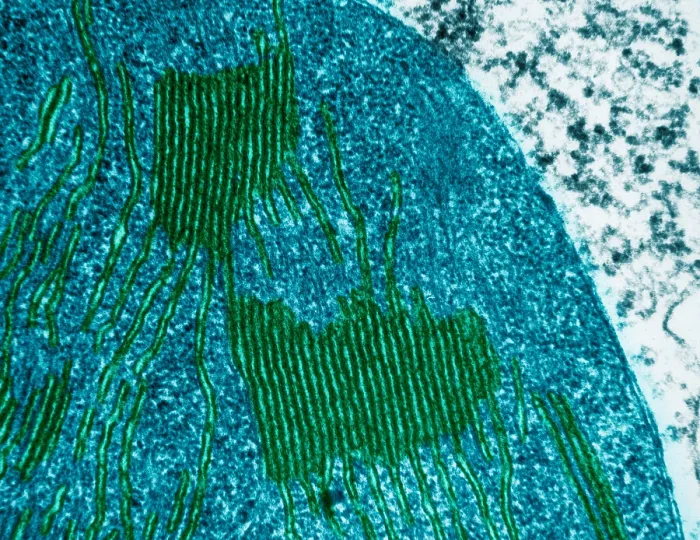 Framed Print : Chloroplasts in Tomato Leaf Cell, TEM Framed Print : Chloroplasts in Tomato Leaf Cell, TEM