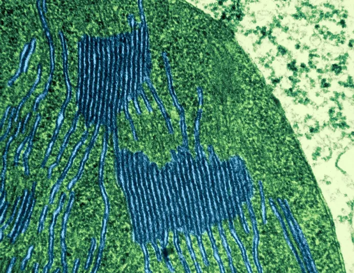 Framed Print : Chloroplasts in Tomato Leaf Cell, TEM Framed Print : Chloroplasts in Tomato Leaf Cell, TEM
