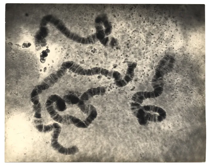 Framed Print : Chromosome Structure, Salivary Glands, Sciara
