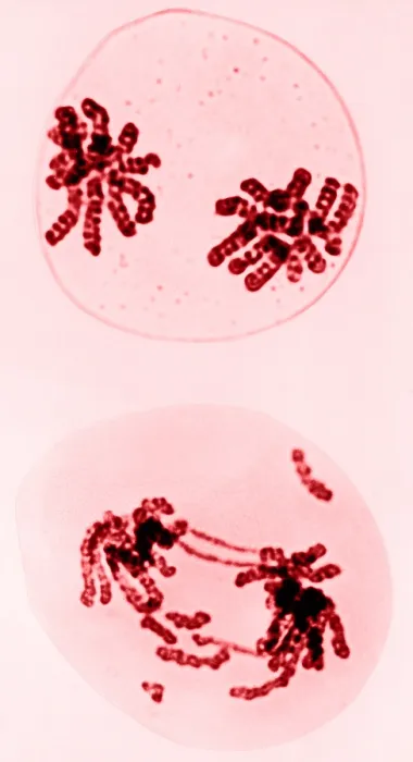 Framed Print : Chromosomes, Radiation Damage, TEM